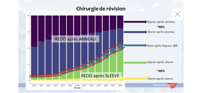 Quelle Solution en cas de reprise de poids après by-pass ? le by-pass sur by-pass 